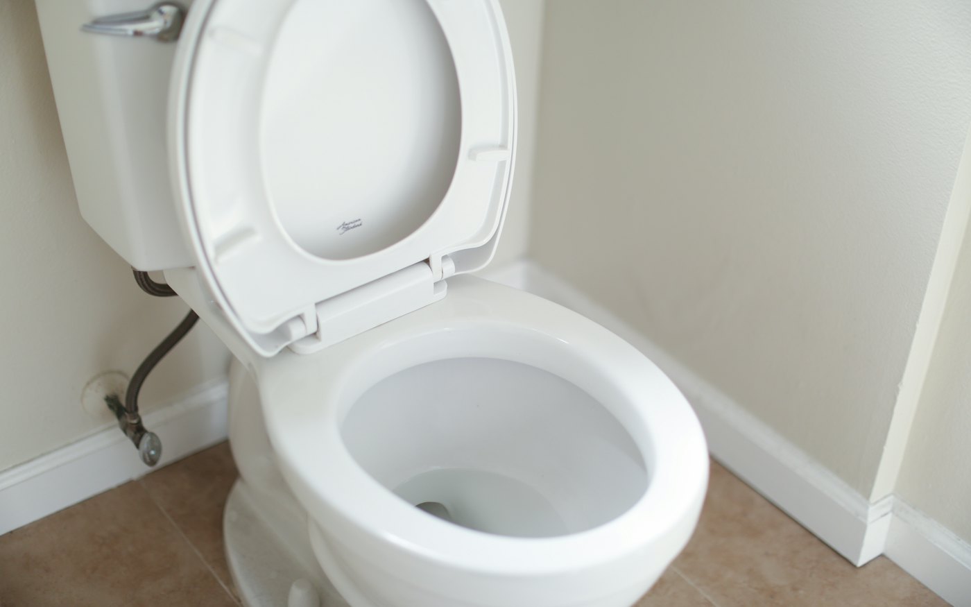 What flies out of a toilet when you flush it with the lid up